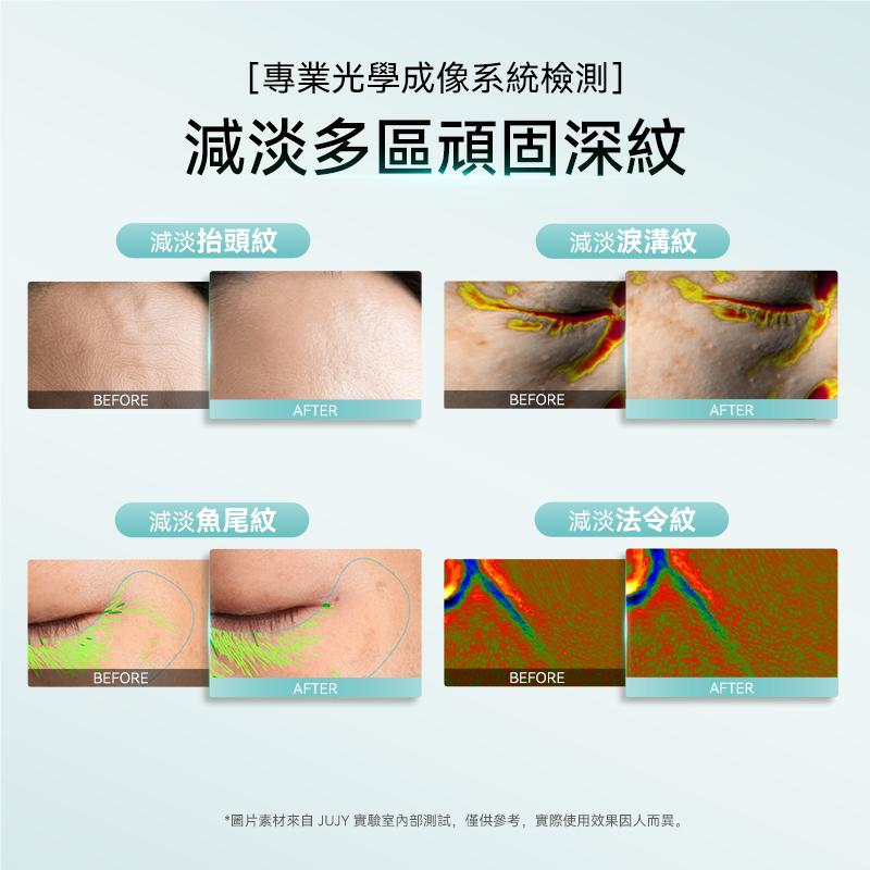 JUJY 小鯨玉 Pro 2.0 冰感緊緻淡紋射頻美容儀｜變頻RF・EMS・三色光護理