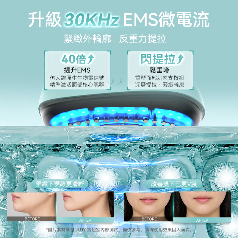 JUJY 小鯨玉 Pro 2.0 冰感緊緻淡紋射頻美容儀｜變頻RF・EMS・三色光護理