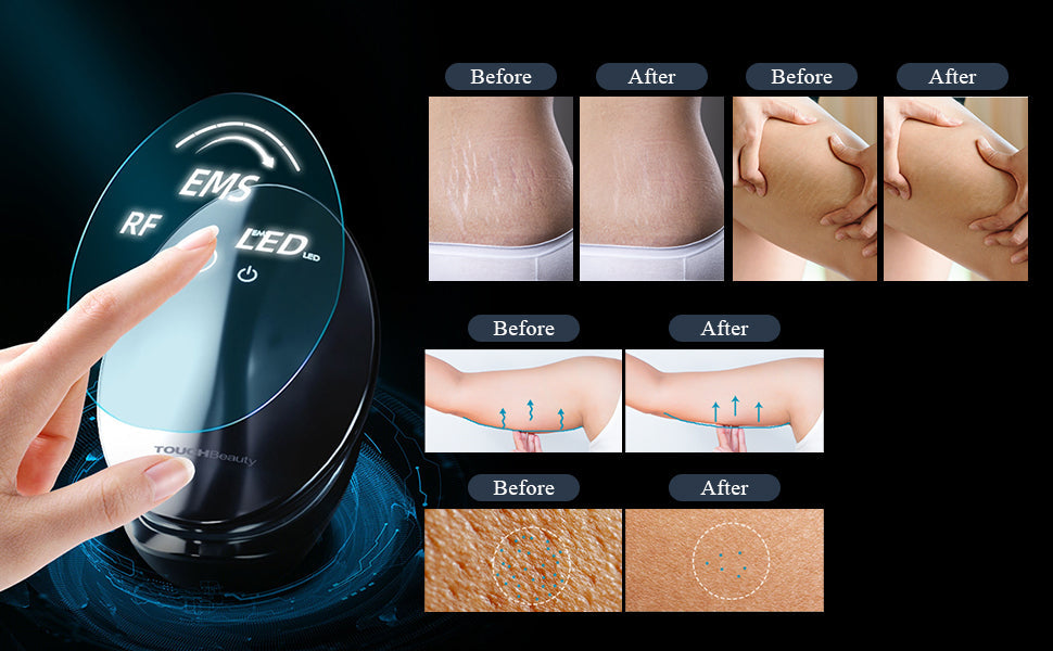 Body Toning & Shaping System | RNR Tech™ RF Radio Frequency + EMS + Red Light + NIR Near Infrared · 16 RF Electrodes · Visible Results in 28 Days · Applicable to Four Body Parts