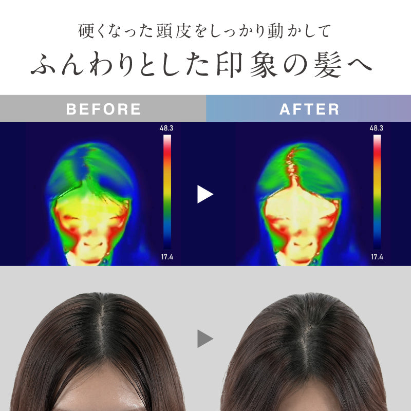 日本 NIPLUX EMS 頭皮按摩器 HEAD SPA PREMIUM｜電動頭皮按摩器 · 面部／頭皮／身體適用 · IPX7 防水無線設計【下單後14日送出】