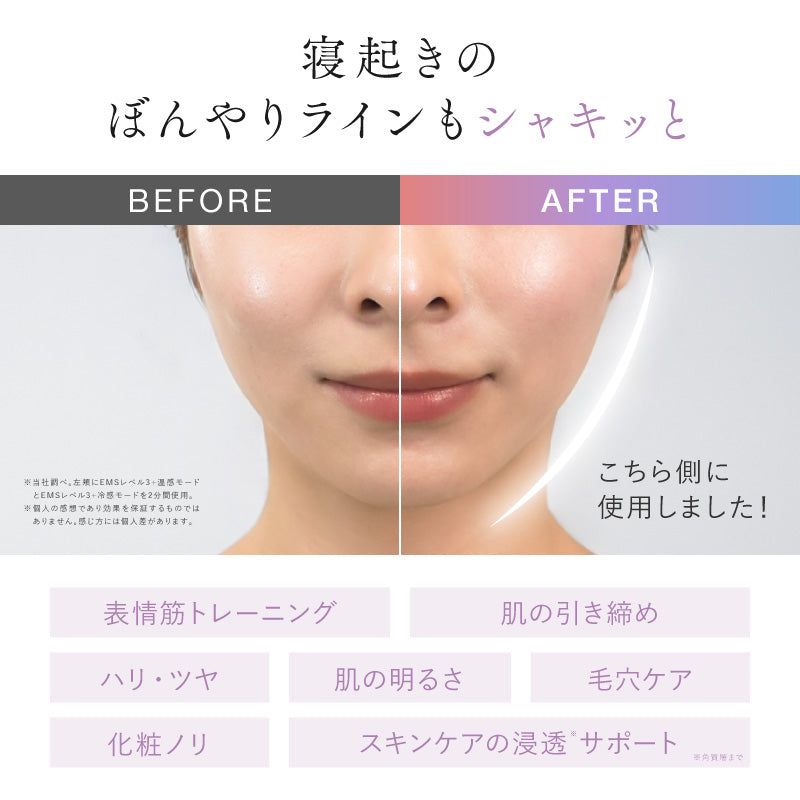 NIPLUX MEGURiS 美顔器｜EMS刮痧×水冷雙科技｜溫感＋LED光療五合一