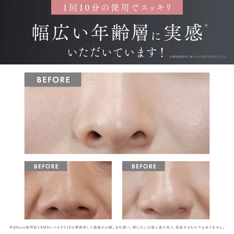 QNose｜日本熱賣 300 萬台鼻部美顏儀 · EMS + 鼻夾 + 藍光 LED · 10 分鐘打造精緻小鼻