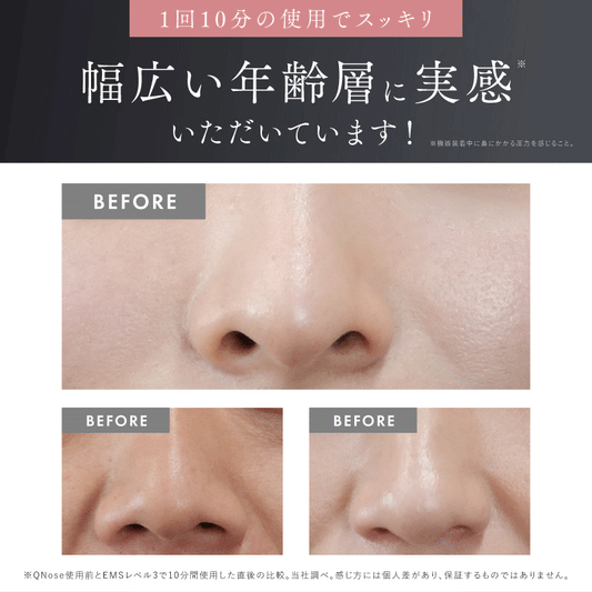 [Pre-order! Ships in 7 days] Japan's best-selling QNose nose-shaping device (3 million units sold) | EMS + Nose Clip + Blue LED | 10 minutes to create a delicate, smaller nose | Improves bulbous noses, fleshy noses, and wide nostrils